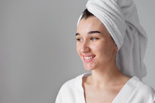 exfoliar piel grasa