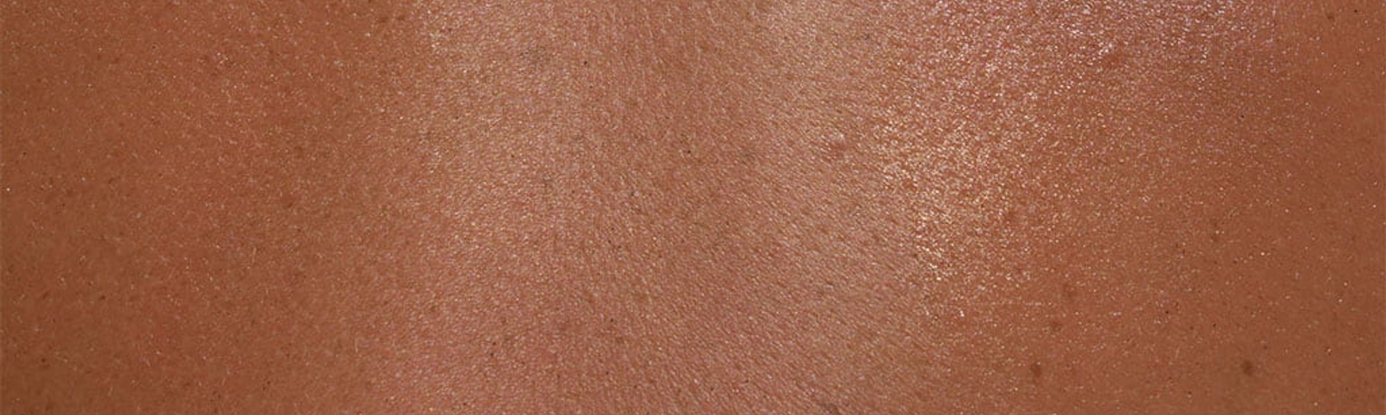 Larocheposay ArticlePage Allergic Skin allergy sensitive skin and reac