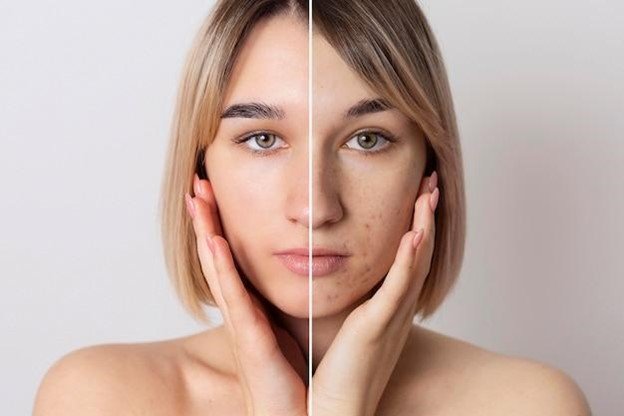 retinol por la noche y vitamina c por la mañana