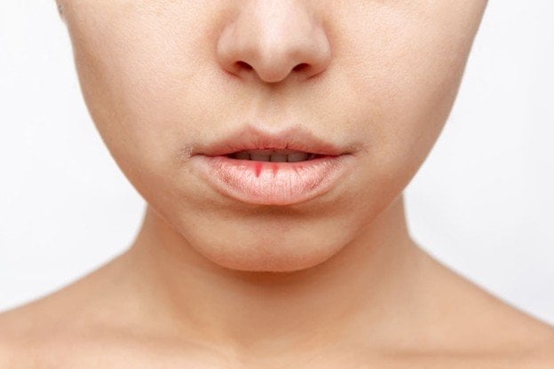 <strong>Labios deshidratados: aprende a repararlos eficazmente</strong>