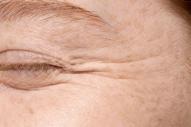 piel rugosa cara