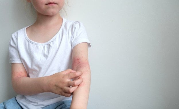 <strong><span>Mejores cremas para la dermatitis y pieles at&oacute;picas</span></strong>