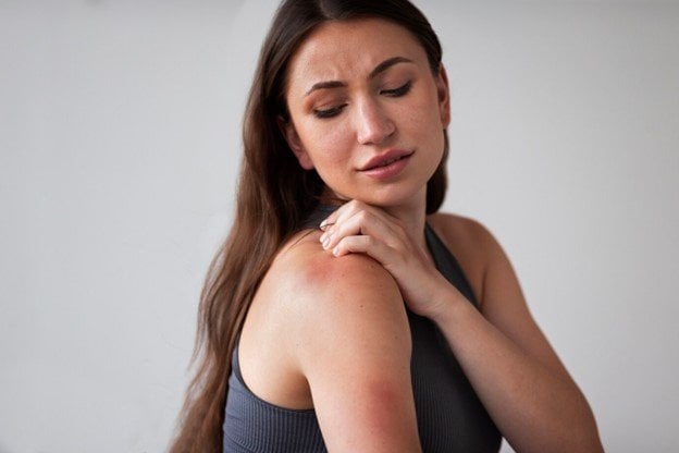 <strong>ZONAS ROJAS Y DESCAMADAS EN LA PIEL:</strong> <strong>OBTÉN MÁS INFORMACIÓN SOBRE LA DERMATITIS SEBORREICA Y CÓMO TRATARLA</strong>