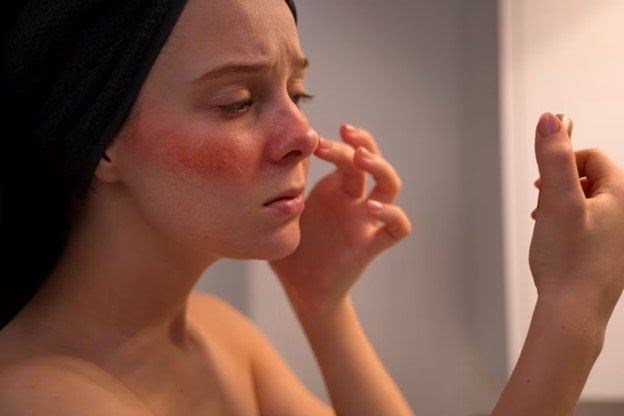 <strong><span>Irritaci&oacute;n en la piel: por qu&eacute; aparece y c&oacute;mo tratarla</span></strong>