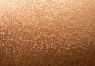 Larocheposay ArticlePage Sensitive Dehydrated skin 