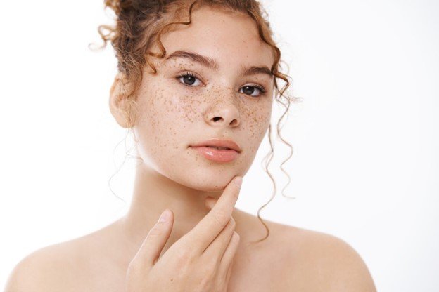 crema para melasma