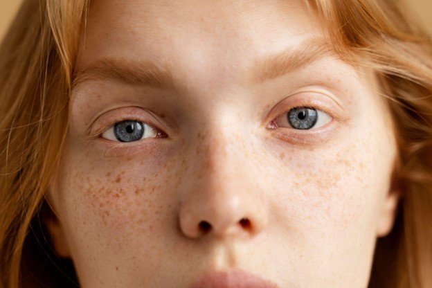pecas por el sol
