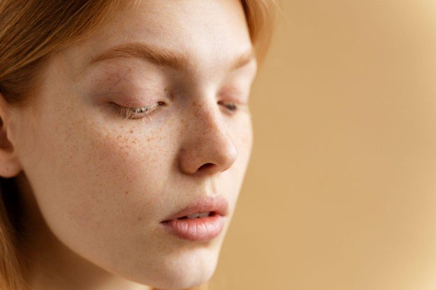 pecas en la nariz