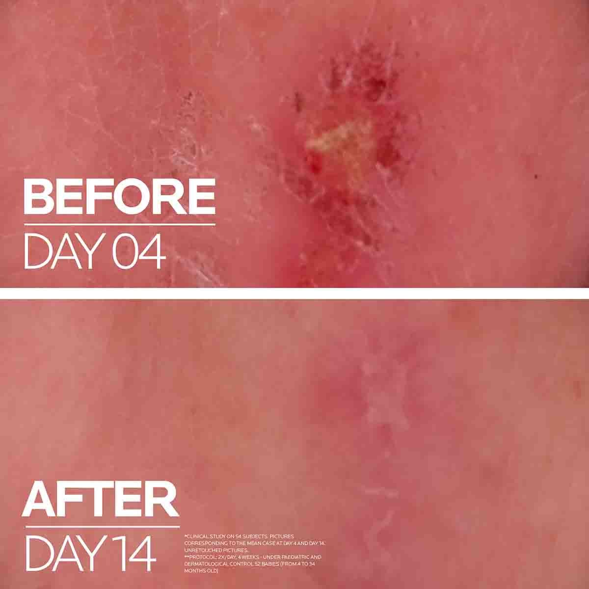 lrp-eretail-product-page-atf-before-after2022
