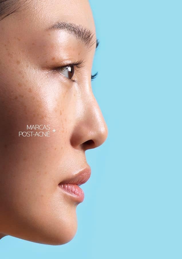 /-/media/project/loreal/brand-sites/lrp/emea/es/products/effaclar/effaclar-a-z-gel-cream/effaclar-az-gel-creme_card-3.jpg