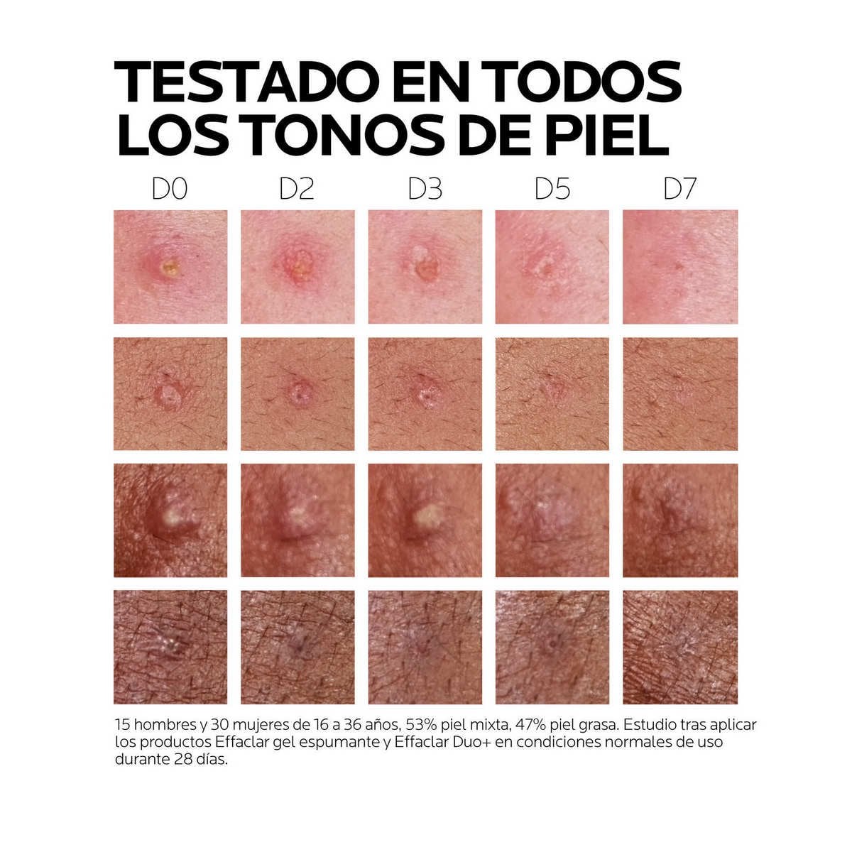 EFFACLAR DUO+M Diversity