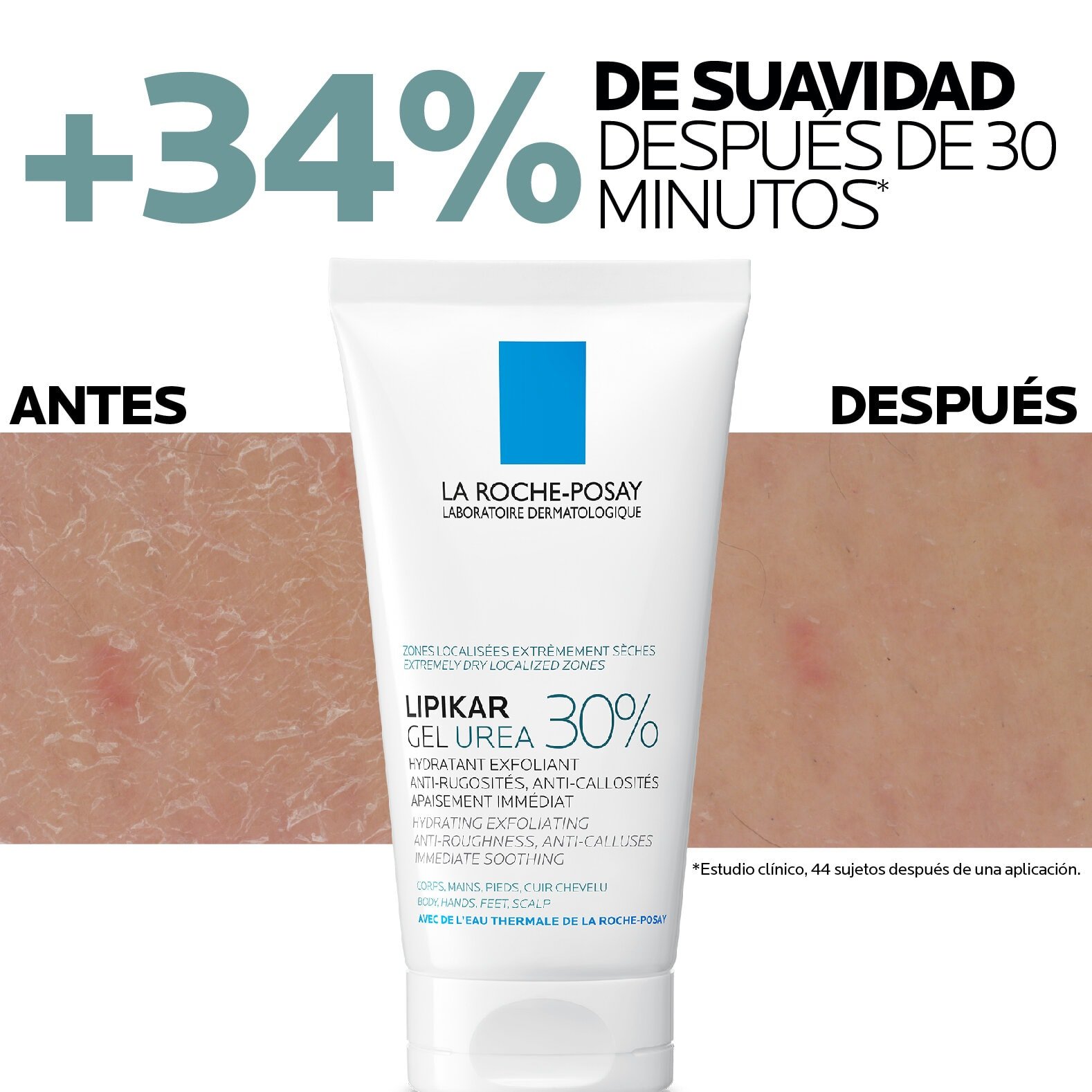 LIPIKAR Gel Urea 30% | Antes y despues