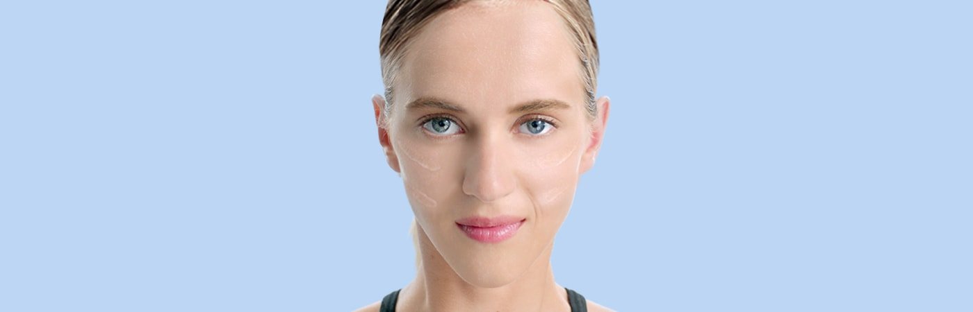 Mujer con imperfecciones en la piel